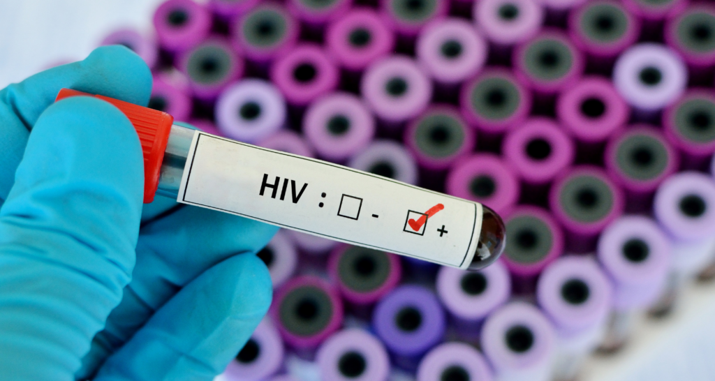 Pemeriksaan Laboratorium Untuk HIV