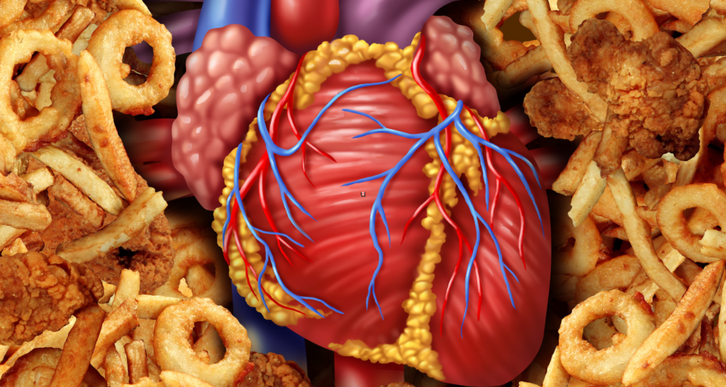 Pencegahan Penyakit Jantung: Pemilihan Makanan yang Tepat