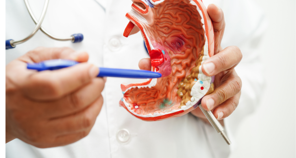 Maag: Makanan yang Perlu Dihindari untuk Mengatasi Gejala