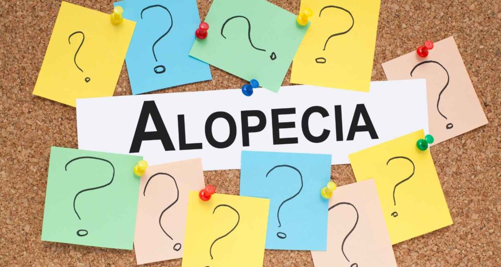 Penyakit Alopecia Areata: Penyebab, Gejala, dan Solusinya!