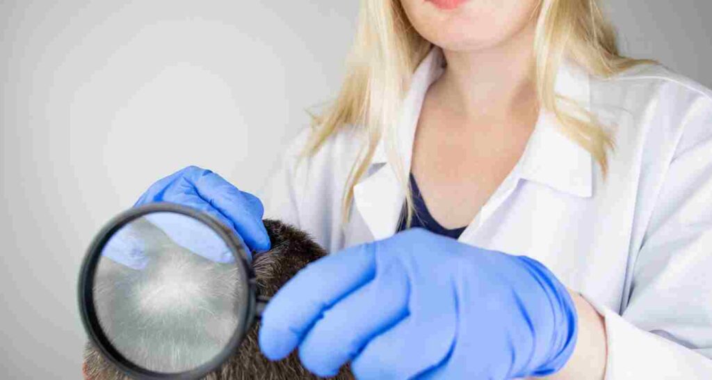 Tes DNA Alopecia Areata: Prediksi Risiko & Solusi Dini