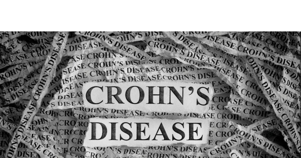 Waspada Penyakit Crohn's! Cegah Sebelum Terlambat!