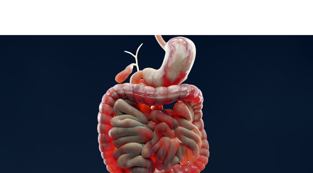 Penyakit Crohn's Bisa Dideteksi DNA, Cek Sekarang!
