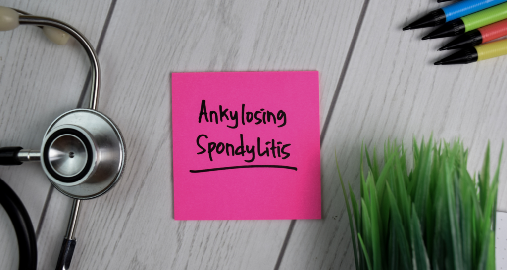 Spondilitis Ankilosa: Penyebab, Gejala, dan penanganannya!