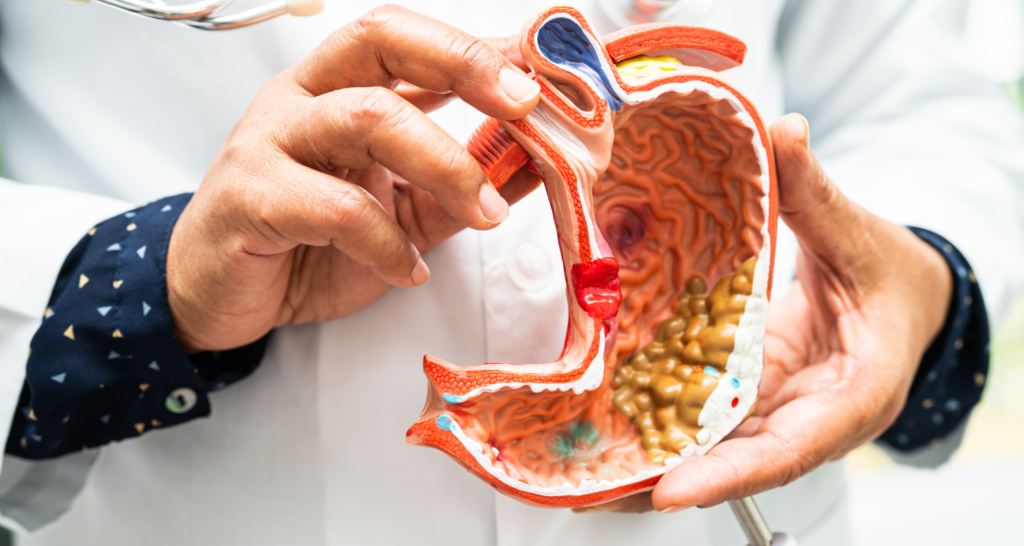 Benarkah Obat Lambung Bisa Picu Stroke? Ini Faktanya!
