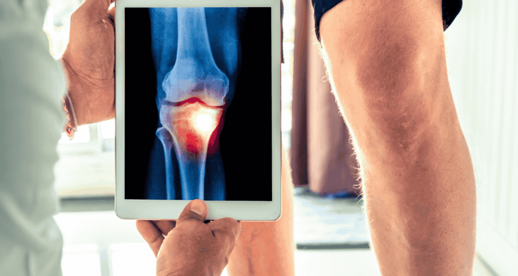 Secretome Apakah Perlu Dilakukan Rontgen Terlebih Dahulu