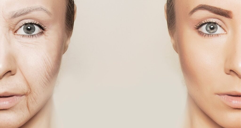 Kenapa bisa terlihat lebih tua?